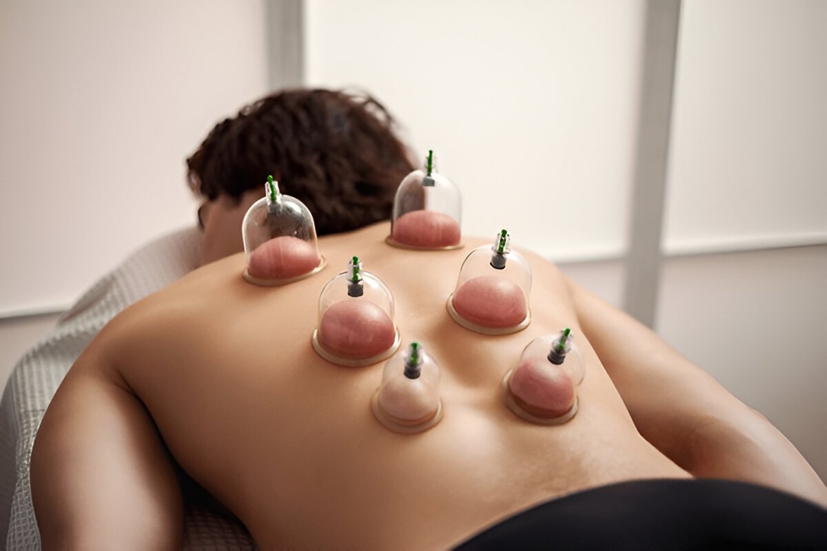 Certificate in Cupping Therapy