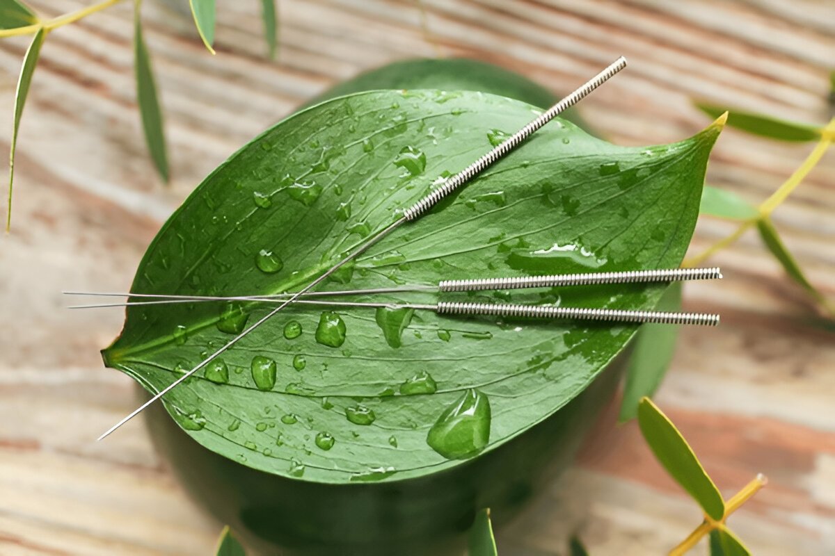 Master Level in Acupuncture Therapy 2nd Year